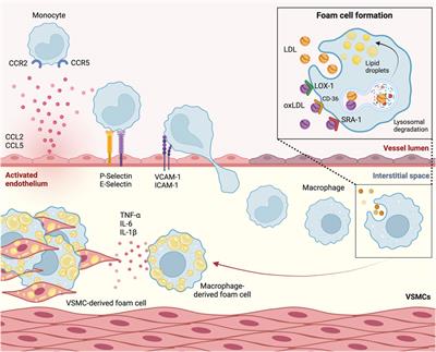 Moving from lipids to leukocytes: inflammation and immune cells in atherosclerosis